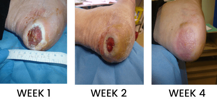 Cvreoz® Advanced Wound Healing Cream for Diabetic Skin 19 Testimonial 5 b2adb41c 8f8a 47de 99b5 97ed0bdb0df0